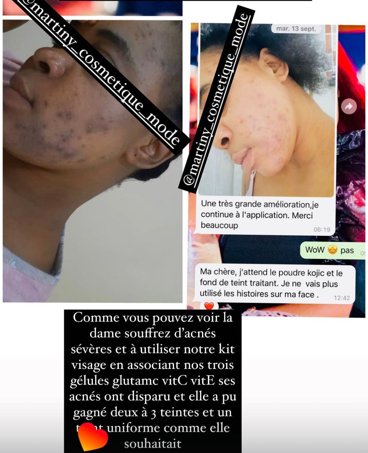 TRIO GÉLULES ÉCLAT – GLUTA MC • VITAMINE C • VITAMINE E - Image 3